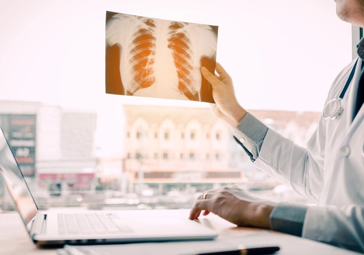 Doctor examining a chest x-ray in a well-lit office with an online education course open on the laptop.
